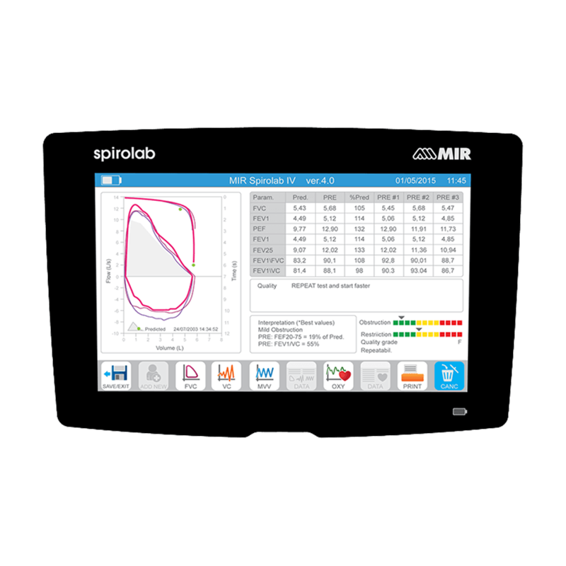 06_Spirolab_Top_View_Spirometry_Results