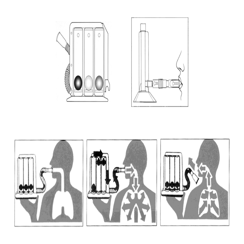 Εξασκητής Αναπνοής Respiprogram 15-243-001 Alfacare